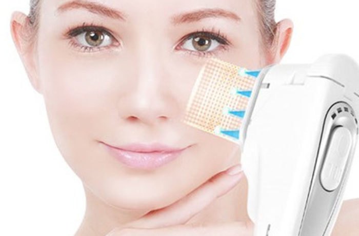 HIFU non-surgical lifting
