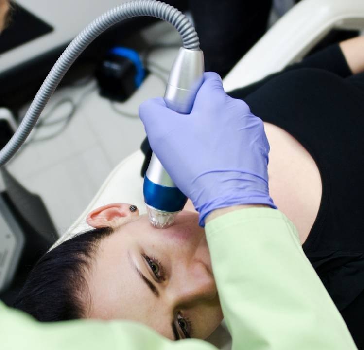 Microneedling radio frequency treatment