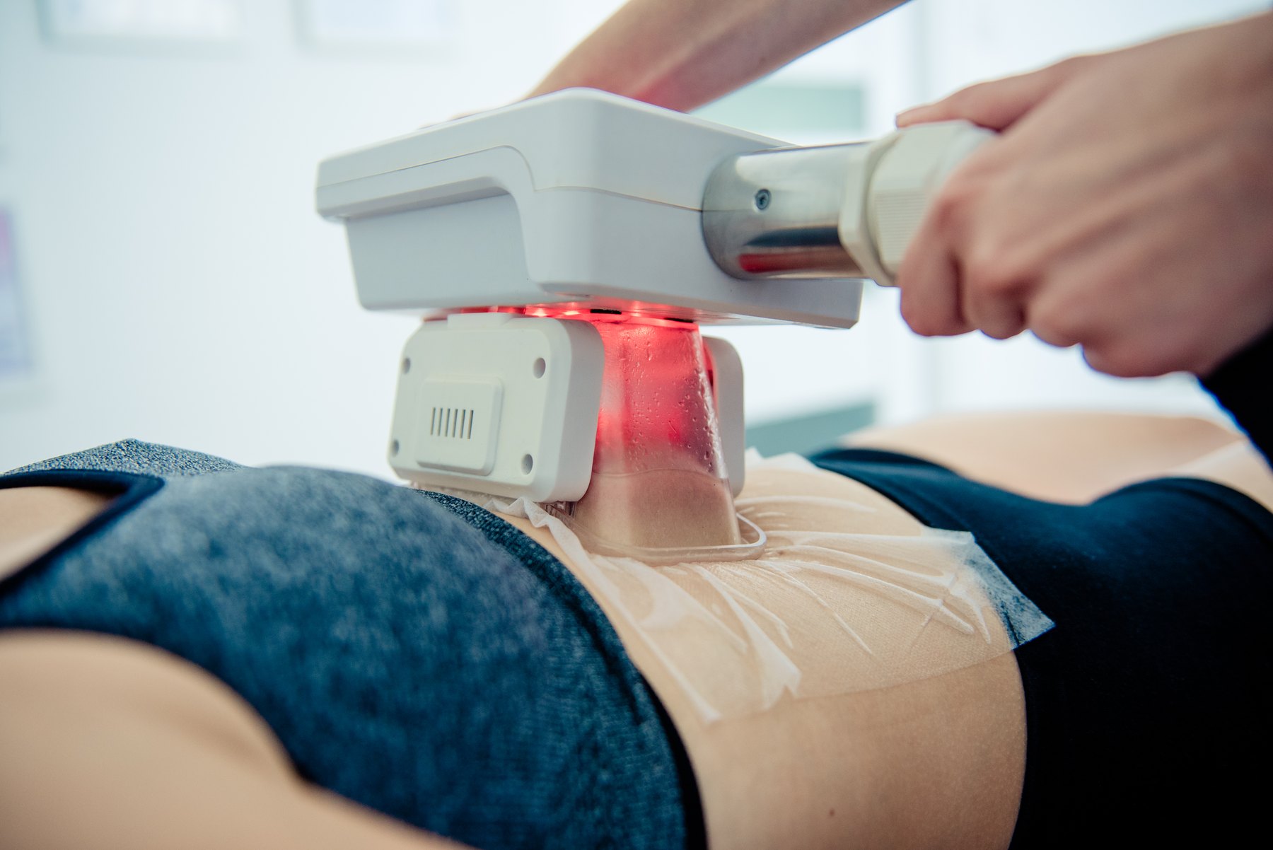 Cryolipolysis body treatment