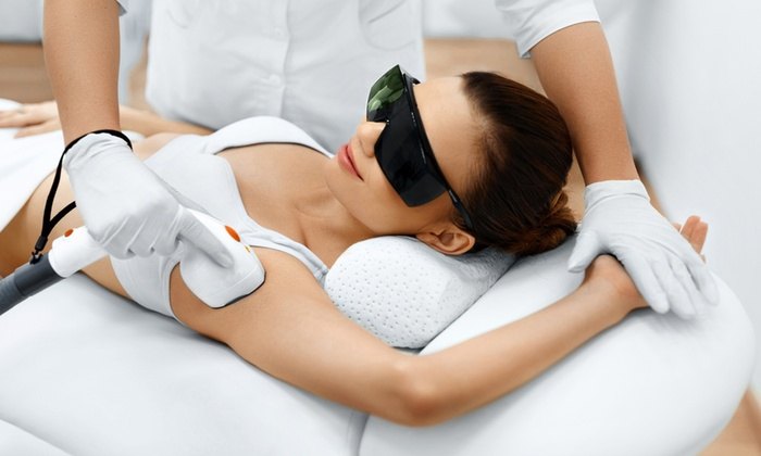 Laser hair removal